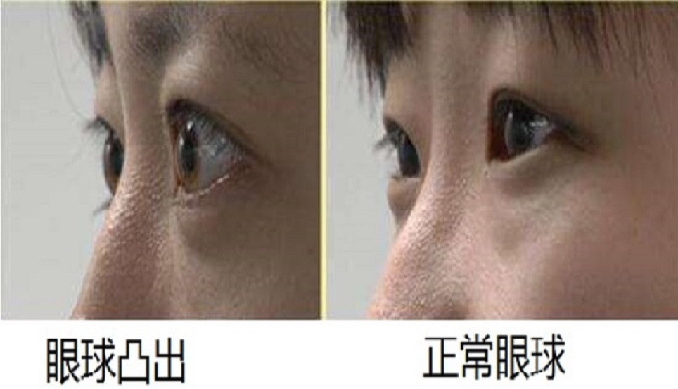 1708928389473405.png 640 (3).png